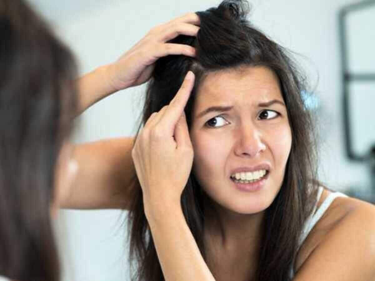 Home remedies for grey hair Home remedies for grey hair