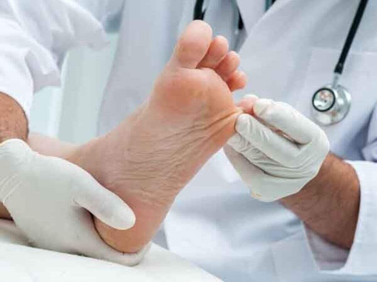 Fungal Infections and Their Home Remedies Fungal Infections and Their Home Remedies