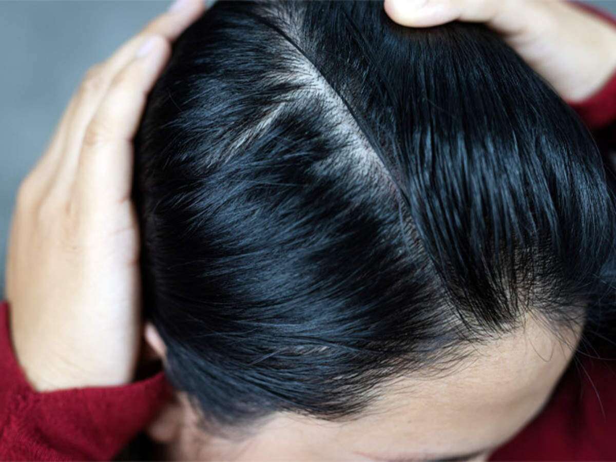 Here's Why Your Hair Is Greasy And Oily After Washing It 